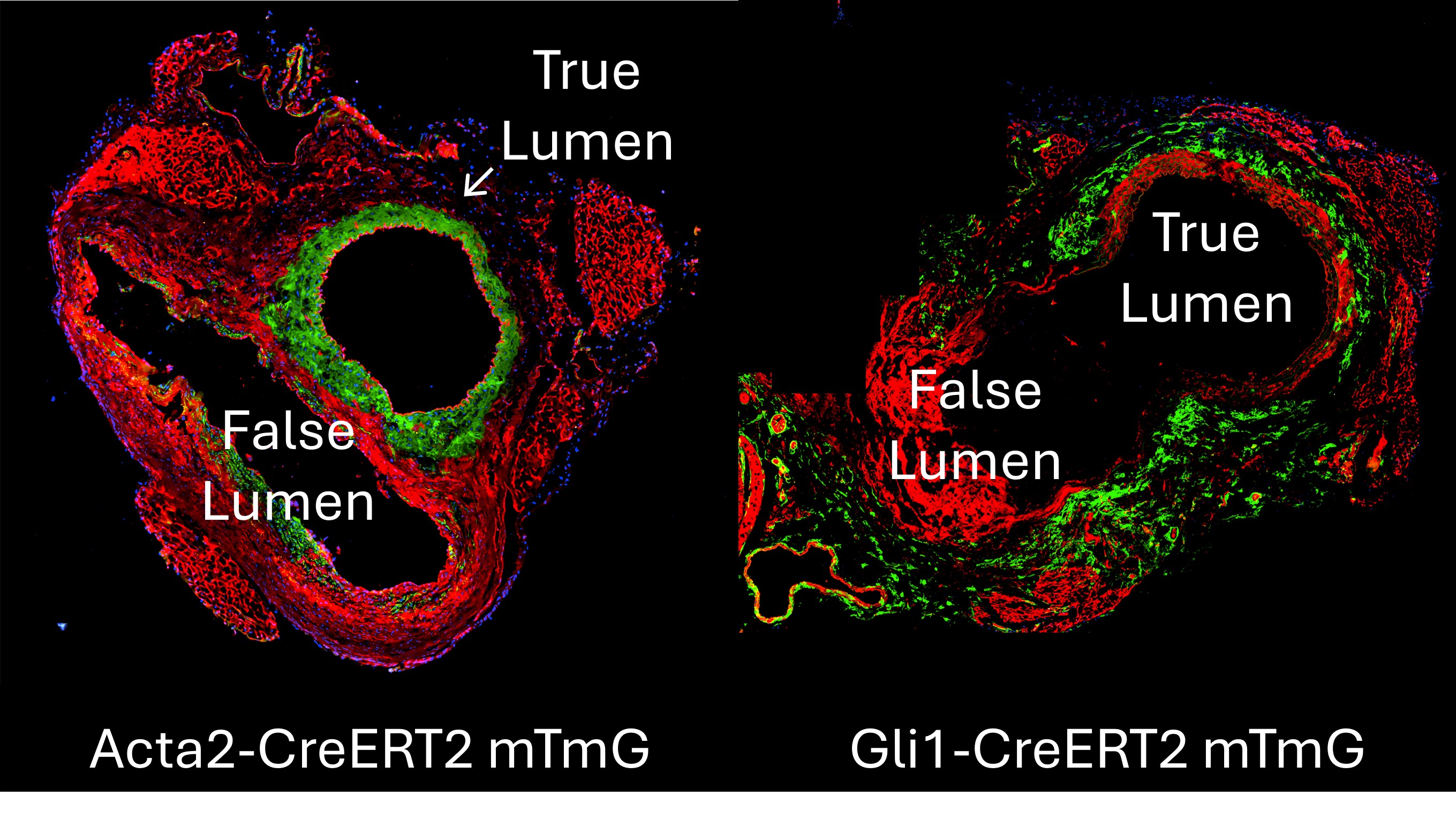 Adventitial Stem Cells